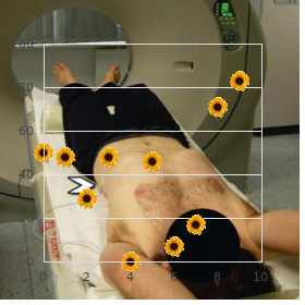 Nemaline myopathy, type 4