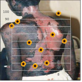 Mastroiacovo Gambi Segni syndrome