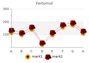 generic 50mg fertomid amex