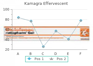 purchase cheap kamagra effervescent on line