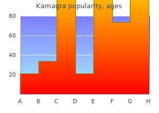 order 50 mg kamagra amex