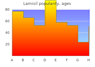 order lamisil with amex