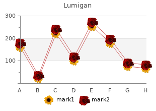 order generic lumigan line