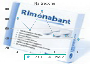 generic naltrexone 50 mg with visa