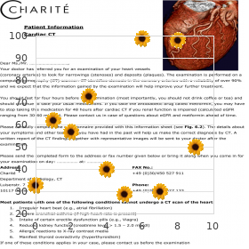 Kartagener syndrome