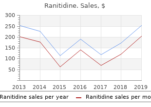 ranitidine 150 mg generic