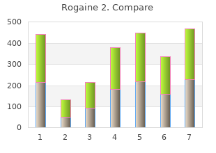 buy generic rogaine 2 line