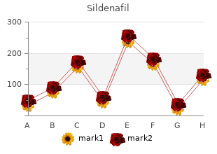 buy sildenafil with amex