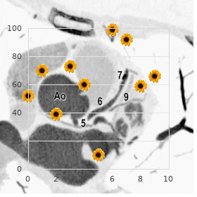 Tsukahara Azuno Kajii syndrome