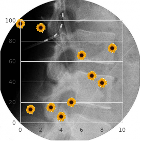 Enchondromatosis dwarfism deafness